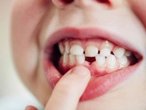 مزایای بهداشت دندان