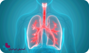 بیماری‌های مربوط به دستگاه تنفس در سالمندان
