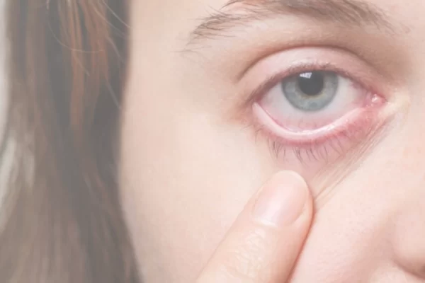 علت پارگی رگهای خونی چشم و روش درمان آن