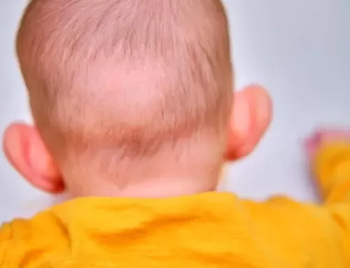 دلایل، پیشگیری و درمان ریزش مو در کودکان
